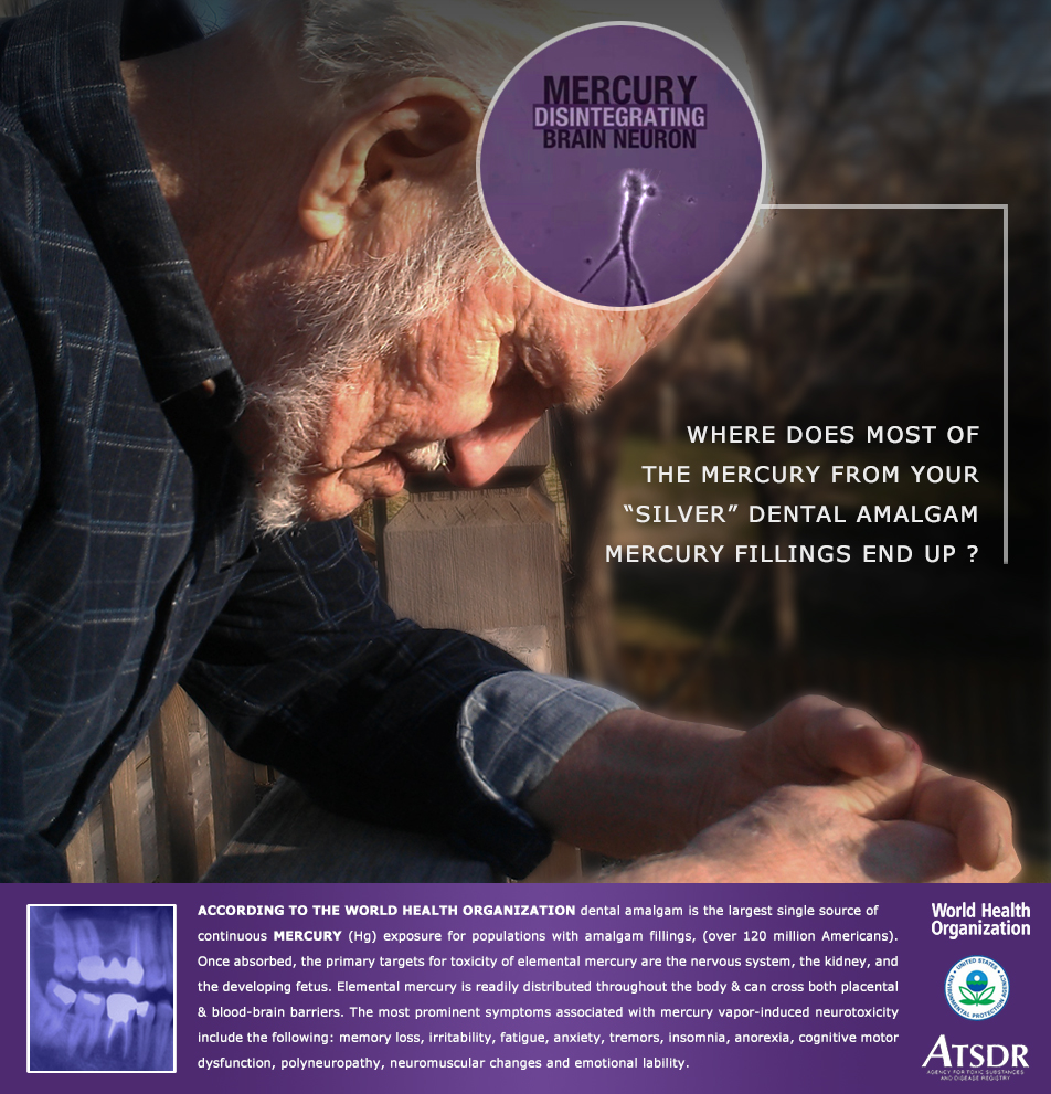 Graphic on where mercury from silver amalgam fillings ends up (WHO/EPA/ATSDR).
