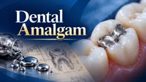 Dental Amalgam