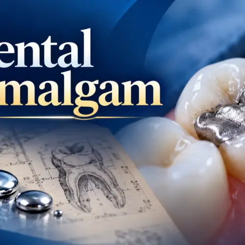 Dental Amalgam